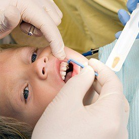 Child receiving fluoride treatment