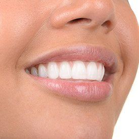 Closeup of patients healthy smile