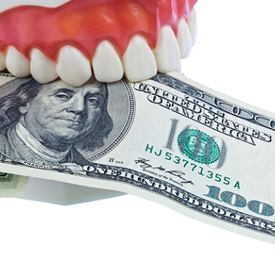 Dental model holding money.