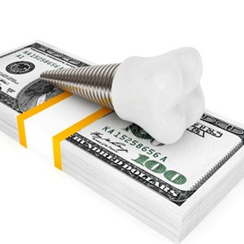 Illustration of a single tooth dental implant sitting on a stack of $100 bills