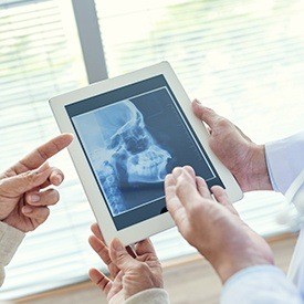 Full profile digital dental x-rays