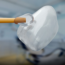 A close-up of veneers and a dental applicator