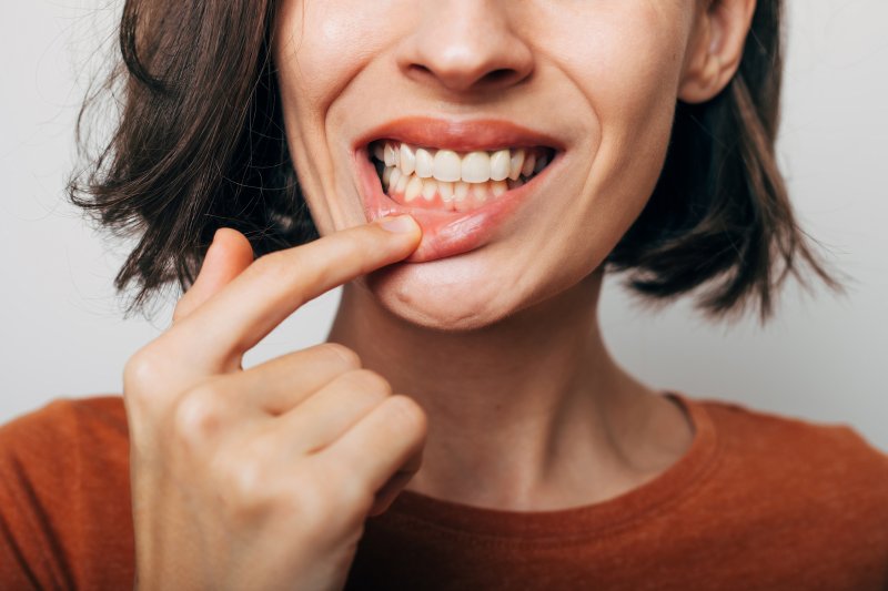 Lady shows inflamed gums